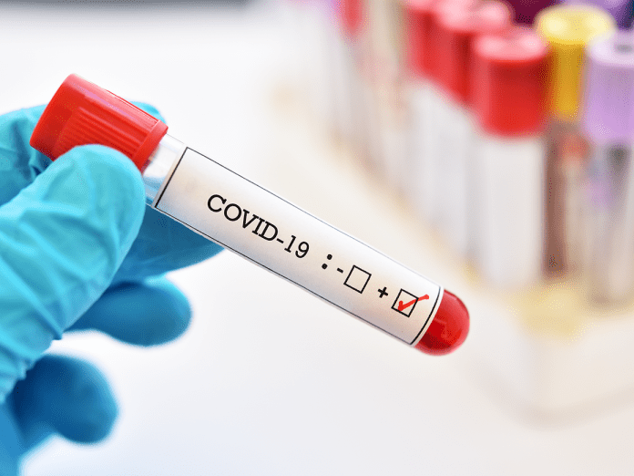 Ccoronavirus test1